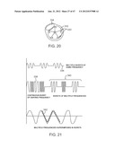 TUNED RF ENERGY FOR SELECTIVE TREATMENT OF ATHEROMA AND OTHER TARGET     TISSUES AND/OR STRUCTURES diagram and image