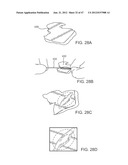 TUNED RF ENERGY FOR SELECTIVE TREATMENT OF ATHEROMA AND OTHER TARGET     TISSUES AND/OR STRUCTURES diagram and image