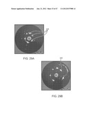 TUNED RF ENERGY FOR SELECTIVE TREATMENT OF ATHEROMA AND OTHER TARGET     TISSUES AND/OR STRUCTURES diagram and image