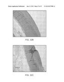 TUNED RF ENERGY FOR SELECTIVE TREATMENT OF ATHEROMA AND OTHER TARGET     TISSUES AND/OR STRUCTURES diagram and image