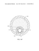 TUNED RF ENERGY AND ELECTRICAL TISSUE CHARACTERIZATION FOR SELECTIVE     TREATMENT OF TARGET TISSUES diagram and image