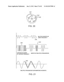 TUNED RF ENERGY AND ELECTRICAL TISSUE CHARACTERIZATION FOR SELECTIVE     TREATMENT OF TARGET TISSUES diagram and image