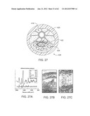 TUNED RF ENERGY AND ELECTRICAL TISSUE CHARACTERIZATION FOR SELECTIVE     TREATMENT OF TARGET TISSUES diagram and image