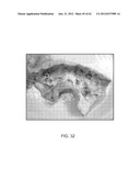 TUNED RF ENERGY AND ELECTRICAL TISSUE CHARACTERIZATION FOR SELECTIVE     TREATMENT OF TARGET TISSUES diagram and image