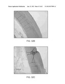 TUNED RF ENERGY AND ELECTRICAL TISSUE CHARACTERIZATION FOR SELECTIVE     TREATMENT OF TARGET TISSUES diagram and image