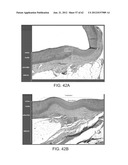 TUNED RF ENERGY AND ELECTRICAL TISSUE CHARACTERIZATION FOR SELECTIVE     TREATMENT OF TARGET TISSUES diagram and image