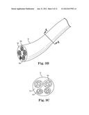 OFF-WALL ELECTRODE DEVICE FOR RENAL NERVE ABLATION diagram and image