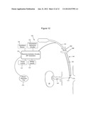 OFF-WALL ELECTRODE DEVICE FOR RENAL NERVE ABLATION diagram and image