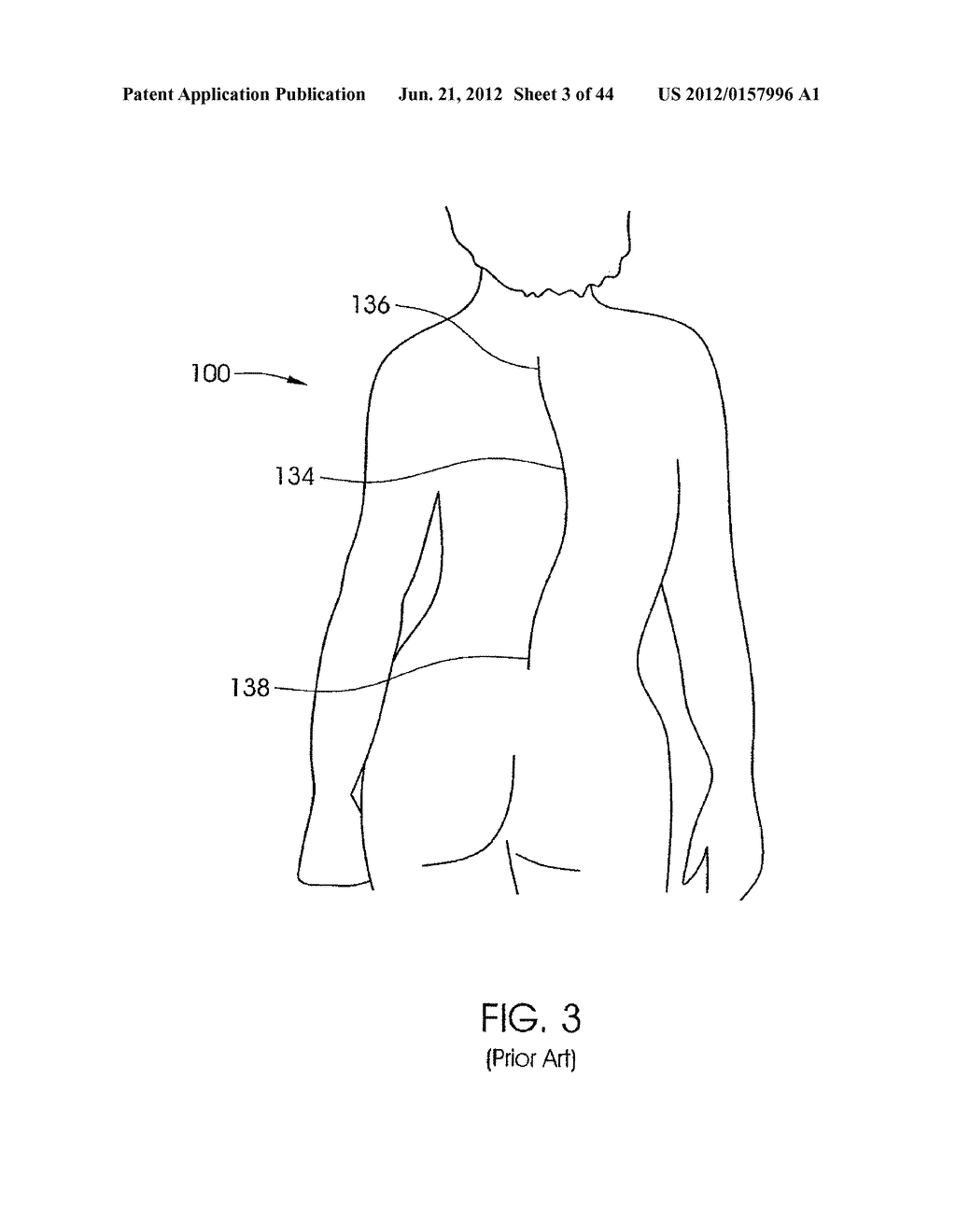 SKELETAL MANIPULATION METHOD - diagram, schematic, and image 04