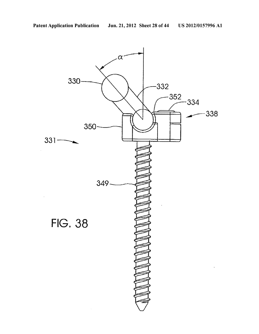 SKELETAL MANIPULATION METHOD - diagram, schematic, and image 29