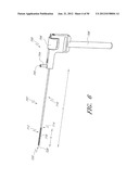 STEERABLE AND CURVABLE VERTEBROPLASTY SYSTEM WITH CLOG-RESISTANT EXIT     PORTS diagram and image