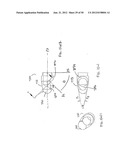 STEERABLE AND CURVABLE VERTEBROPLASTY SYSTEM WITH CLOG-RESISTANT EXIT     PORTS diagram and image