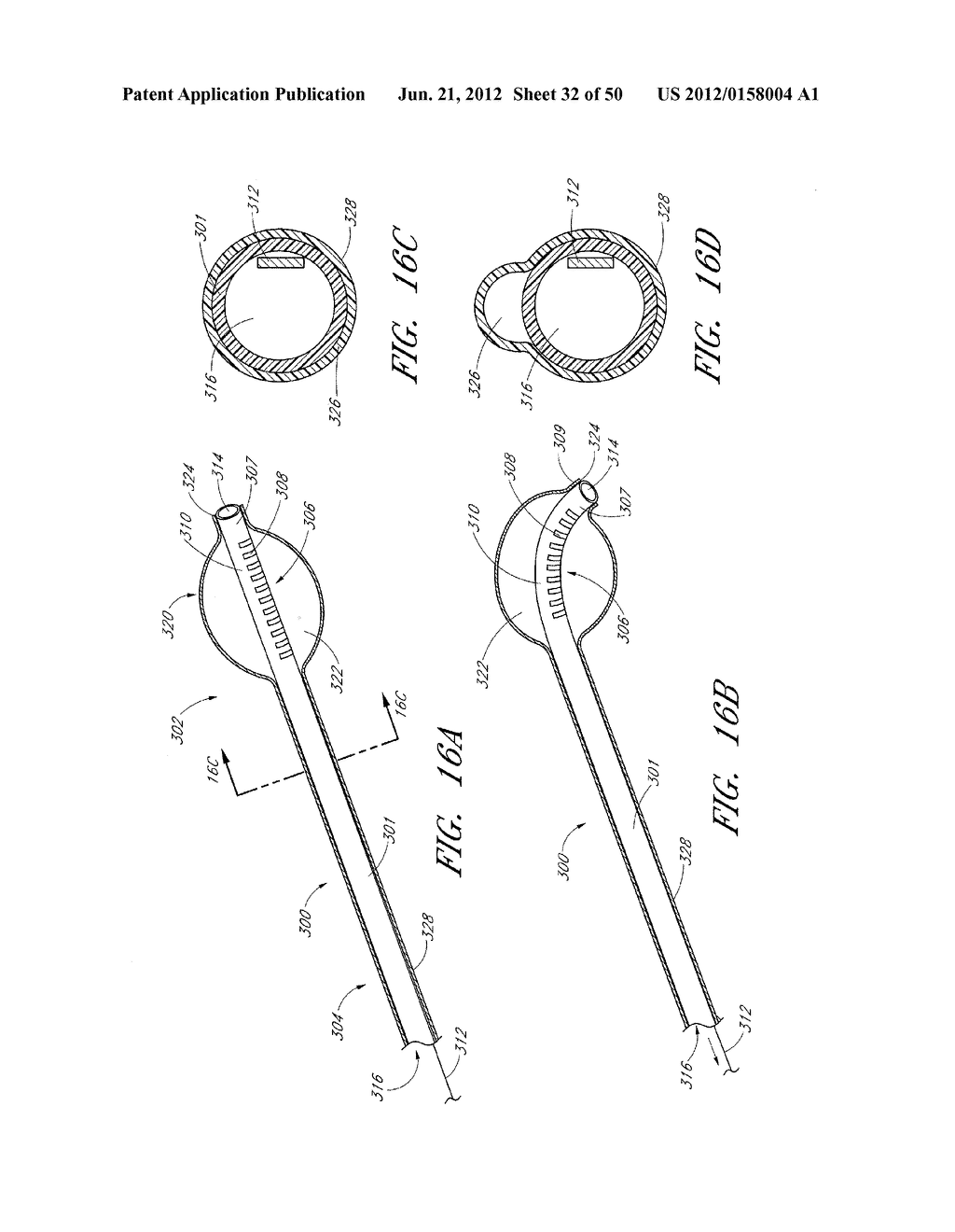 STEERABLE AND CURVABLE VERTEBROPLASTY SYSTEM WITH CLOG-RESISTANT EXIT     PORTS - diagram, schematic, and image 33