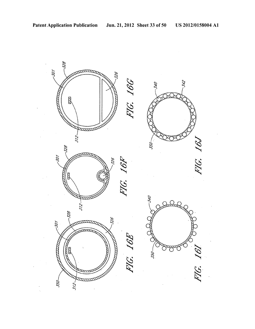 STEERABLE AND CURVABLE VERTEBROPLASTY SYSTEM WITH CLOG-RESISTANT EXIT     PORTS - diagram, schematic, and image 34