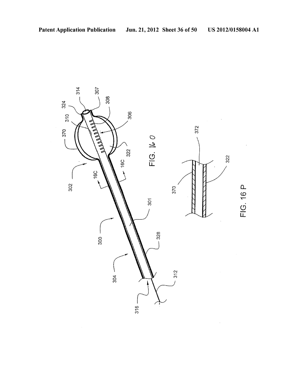 STEERABLE AND CURVABLE VERTEBROPLASTY SYSTEM WITH CLOG-RESISTANT EXIT     PORTS - diagram, schematic, and image 37