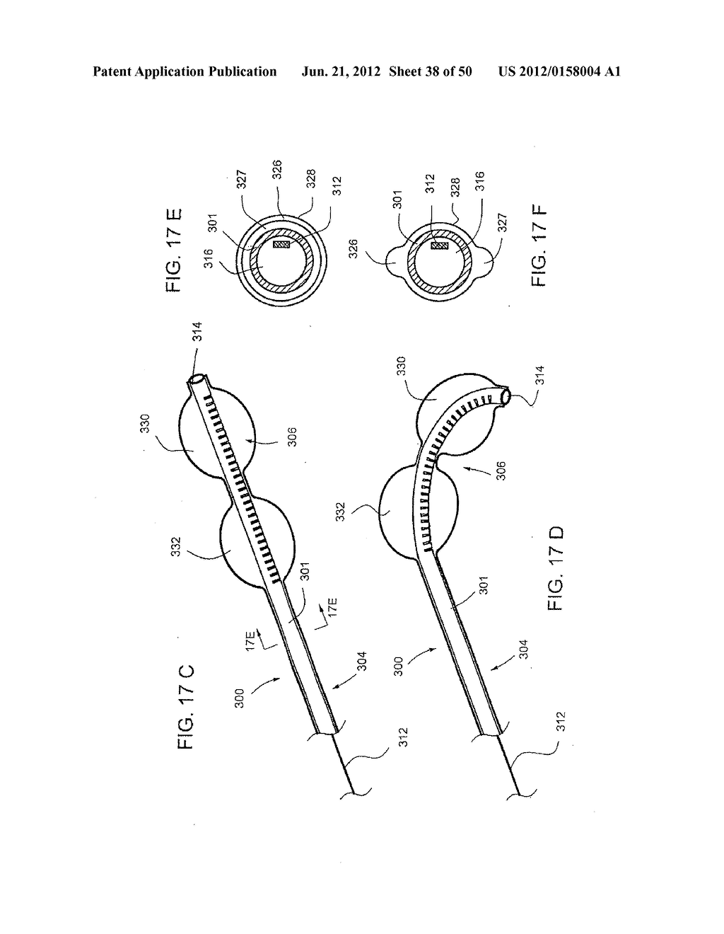 STEERABLE AND CURVABLE VERTEBROPLASTY SYSTEM WITH CLOG-RESISTANT EXIT     PORTS - diagram, schematic, and image 39