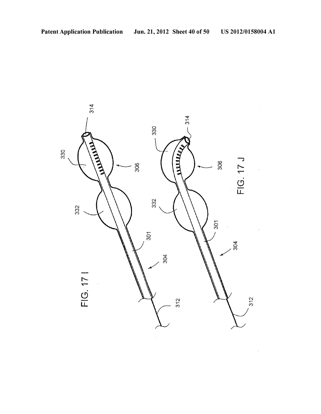 STEERABLE AND CURVABLE VERTEBROPLASTY SYSTEM WITH CLOG-RESISTANT EXIT     PORTS - diagram, schematic, and image 41