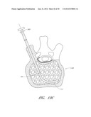 STEERABLE AND CURVABLE VERTEBROPLASTY SYSTEM WITH CLOG-RESISTANT EXIT     PORTS diagram and image