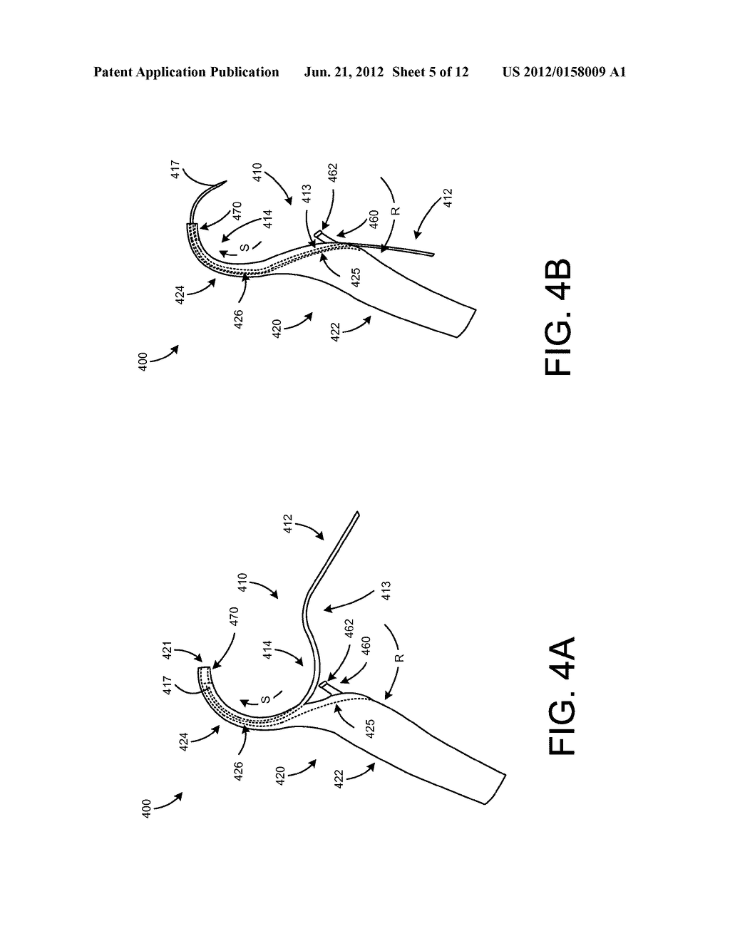 MOVABLE CURVED NEEDLE FOR DELIVERING IMPLANTS AND METHODS OF DELIVERING     IMPLANTS - diagram, schematic, and image 06