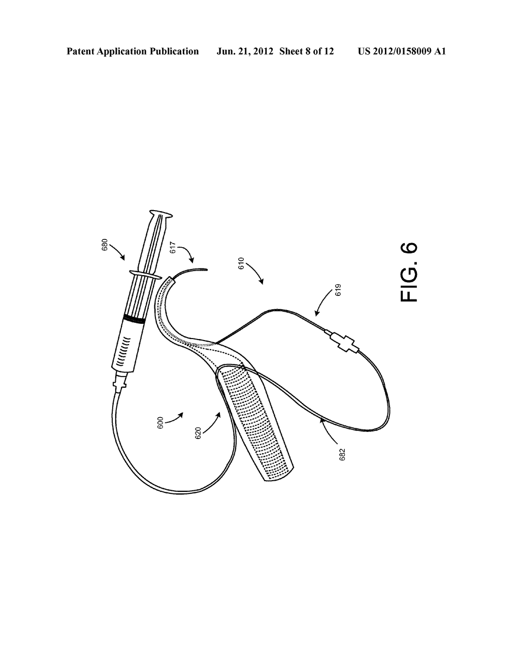 MOVABLE CURVED NEEDLE FOR DELIVERING IMPLANTS AND METHODS OF DELIVERING     IMPLANTS - diagram, schematic, and image 09