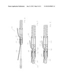 Endoscopic Suture Cinch System diagram and image