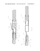 Endoscopic Suture Cinch System diagram and image