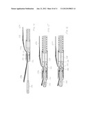 Endoscopic Suture Cinch System diagram and image