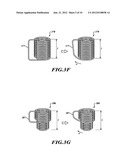 IMPLANTABLE APPARATUS FOR FACILITATING IMAGING-BASED DIAGNOSES diagram and image