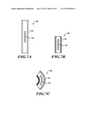 IMPLANTABLE APPARATUS FOR FACILITATING IMAGING-BASED DIAGNOSES diagram and image