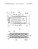 CONFIGURATION AND METHOD FOR FIXATION OF A FILTER TO A CATHETER diagram and image