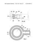 CONFIGURATION AND METHOD FOR FIXATION OF A FILTER TO A CATHETER diagram and image