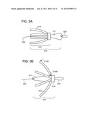 SUTURE ANCHORING ASSEMBLIES AND METHODS OF USE diagram and image