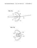 SUTURE ANCHORING ASSEMBLIES AND METHODS OF USE diagram and image