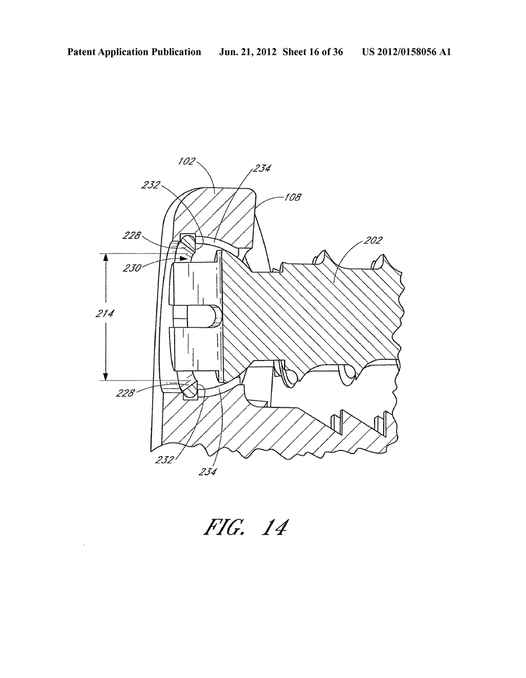 ORTHOPEDIC EXPANSION FASTENER - diagram, schematic, and image 17