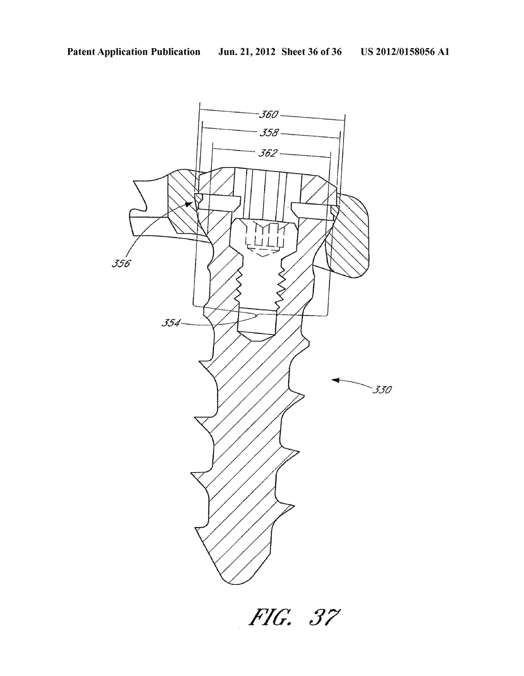 ORTHOPEDIC EXPANSION FASTENER - diagram, schematic, and image 37