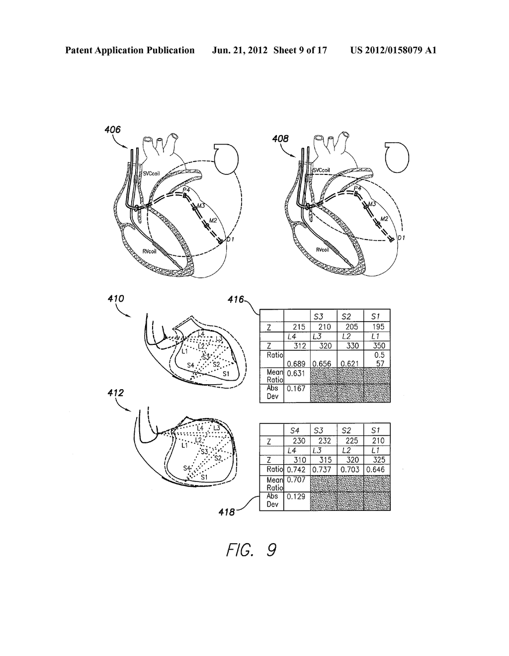 SYSTEMS AND METHODS FOR ASSESSING THE SPHERICITY AND DIMENSIONAL EXTENT OF     HEART CHAMBERS FOR USE WITH AN IMPLANTABLE MEDICAL DEVICE - diagram, schematic, and image 10