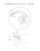 PACEMAKER WITH NO PRODUCTION diagram and image