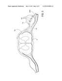 DEVICES, SYSTEMS AND METHODS FOR THE TARGETED TREATMENT OF MOVEMENT     DISORDERS diagram and image