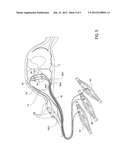 DEVICES, SYSTEMS AND METHODS FOR THE TARGETED TREATMENT OF MOVEMENT     DISORDERS diagram and image