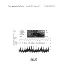 COOLING OF LOCALIZED AREAS OF THE BODY FOR CEREBRAL BLOOD FLOW     AUGMENTATION diagram and image