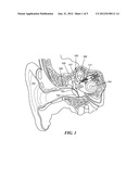 Multichannel Cylindrical Electrode For Nerve Stimulation And Recording diagram and image