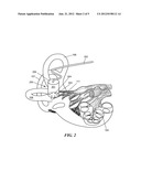 Multichannel Cylindrical Electrode For Nerve Stimulation And Recording diagram and image