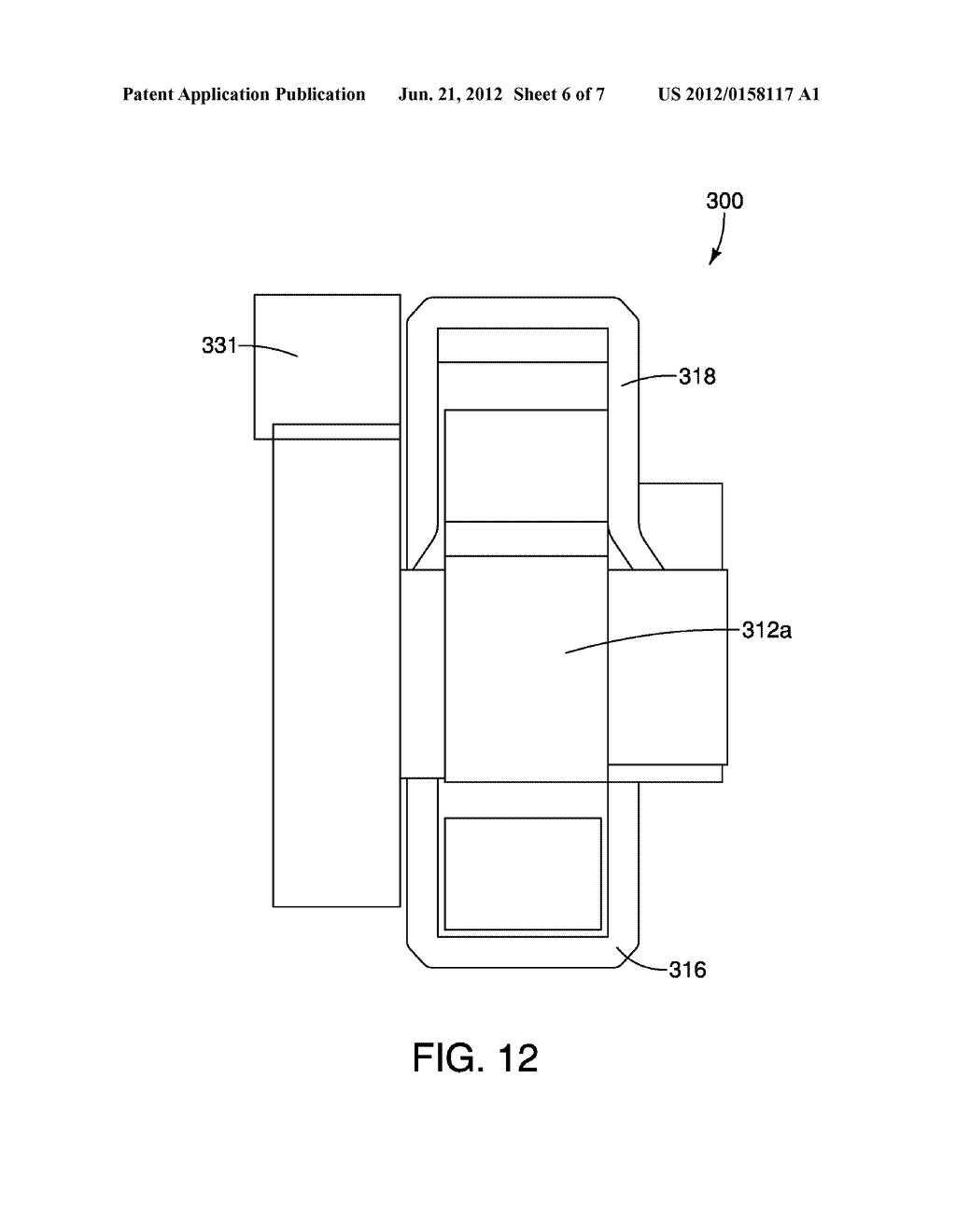 Handle Control System for a Stent Delivery System - diagram, schematic, and image 07