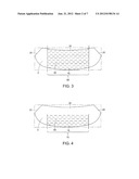 Mastopexy and Breast Reconstruction Prostheses and Method diagram and image