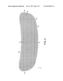 Mastopexy and Breast Reconstruction Prostheses and Method diagram and image