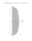 Mastopexy and Breast Reconstruction Prostheses and Method diagram and image