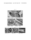 EXTRACELLULAR VESICLES DERIVED FROM GRAM-POSITIVE BACTERIA, AND USE     THEREOF diagram and image