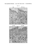 EXTRACELLULAR VESICLES DERIVED FROM GRAM-POSITIVE BACTERIA, AND USE     THEREOF diagram and image