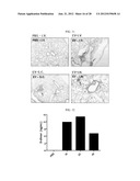 EXTRACELLULAR VESICLES DERIVED FROM GRAM-POSITIVE BACTERIA, AND USE     THEREOF diagram and image