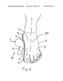 FOOT ALIGNMENT TOOL diagram and image